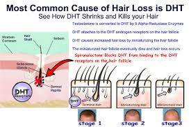 topical spironolactone hair loss