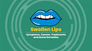 unsuretoinsured swollen lips