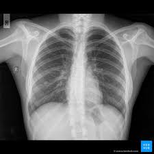 radiological anatomy x ray ct mri