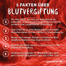 Possible causes, signs and symptoms, standard treatment options and sepsis happens when an infection spreads and causes your body to react strongly to germs. Blutvergiftung Sepsis Anzeichen Ursachen Behandlung Symptome Gesundheit De