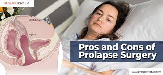 prolapse surgery