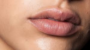 how chapped lips could be caused by dry