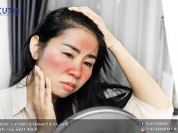 is your skin e to redness