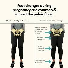 foot changes during pregnancy impact