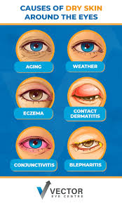 what causes dry skin around the eyes