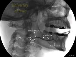 anatomy of submandibular gland and duct
