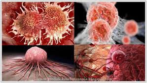 Hasil gambar untuk kanker dan tumor