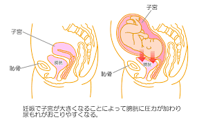 妊婦に起きやすい尿もれ対策【妊娠中のトラブルシューティング・8】 | kodomoe（コドモエ）—「親子時間」を楽しむ子育て情報が満載！