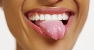 dry mouth symptoms and causes