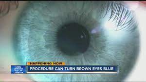 procedure can turn brown eyes blue
