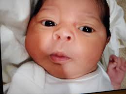 newborn s rash involves eyes and nose