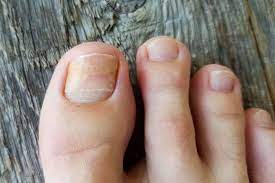common nail conditions diagnosis and
