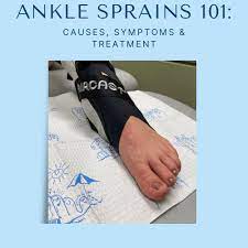 ankle sprains 101 causes symptoms and