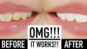 whiten teeth instantly with makeup