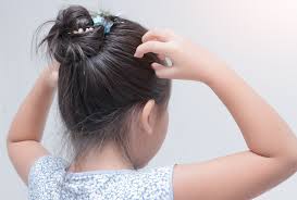 head lice treatment 5 natural home