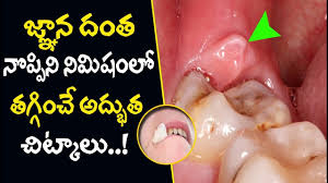 wisdom tooth pain relief telugu tooth
