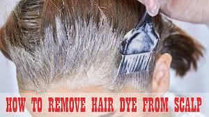 Getting your hair dyed is always exciting, but doing it at home tends to be messy. How To Remove Hair Dye From Scalp 7 Easy Hacks Lewigs