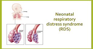 The symptoms of neonatal respiratory distress syndrome include Respiratory Distress In Infants And Adults Brave Beginnings
