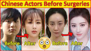 chinese actors before and after plastic