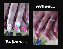 It took long 8 months to get them back into shape! Take Off Acrylic Nails At Home Pain Free With Acetone And Oil