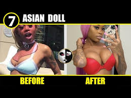 asian doll plastic surgery before and