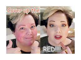 makeup to cover up redness rosacea