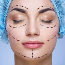 Cirugía facial – Camila Arenas