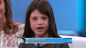 How old is mia robertson of the voice? How Cleft Lips Occur In The Womb Duck Dynasty Part 2 Youtube