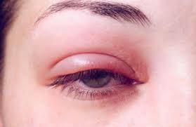 is eye makeup safe for eyes correct