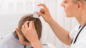 head lice causes symptoms and ent at
