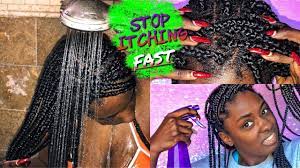 box braid series stop itchy scalp fast