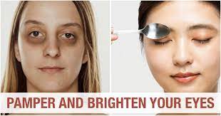 12 ways to brighten dark under eye area