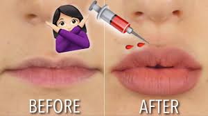 how to get fuller lips at home no