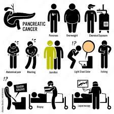 pancreatic pancreas cancer symptoms