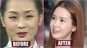Celebrities, korean communities do not paint plastic and cosmetic surgery in a negative light—instead, they embrace it as a means to. Shocking Transformation Of Korean Celebrities Reason Why They Addicted To Plastic Surgery Youtube