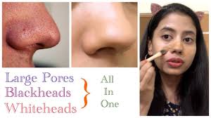 Before we go into details, however, let us start by mentioning that the point here is not to get rid of pores altogether. How To Get Rid Of Large Pores Blackheads Whiteheads Primers For Oily Skin Youtube