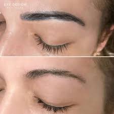 permanent makeup removal my cms