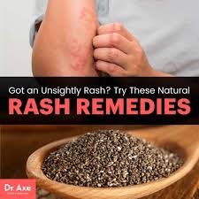 natural rash remes