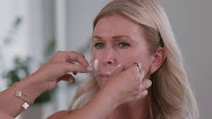 get rid of deep mouth wrinkles remove