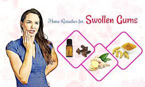 best home remes for healing swollen gums