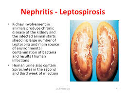 Image result for leptospirosis