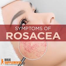 rosacea symptoms causes treatment