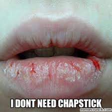 want your chapped lips gone let it show