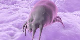 dust mite allergy here we show you how
