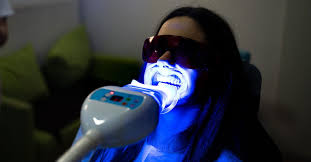 laser teeth whitening procedure