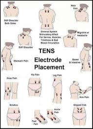 How To Use Your Tens Unit For Natural Arthritis Relief