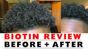 Olly's ultra hair is formulated to promote strong hair, prevent breakage, preserve pigment, and encourage hair growth. Biotin Hair Growth Results Before And After Youtube