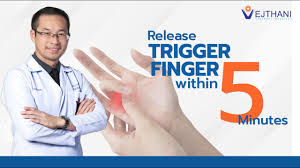 trigger finger can be released within 5