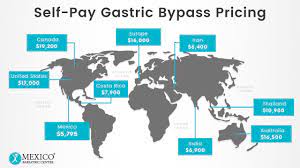 gastric byp surgery costs