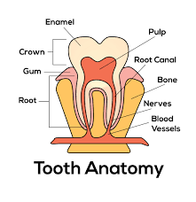 Root caries